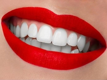 Brighten and Whiten Your Smile