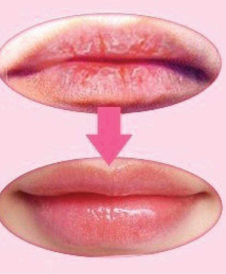 Hack for Chapped lips